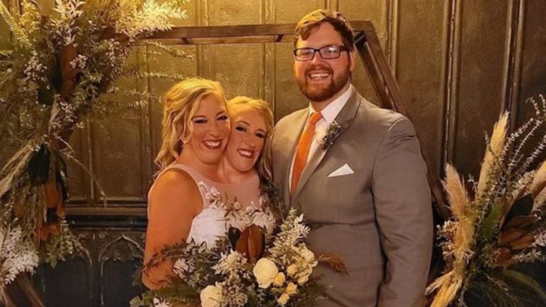 gêmeas siamensas e noivo durante casamento