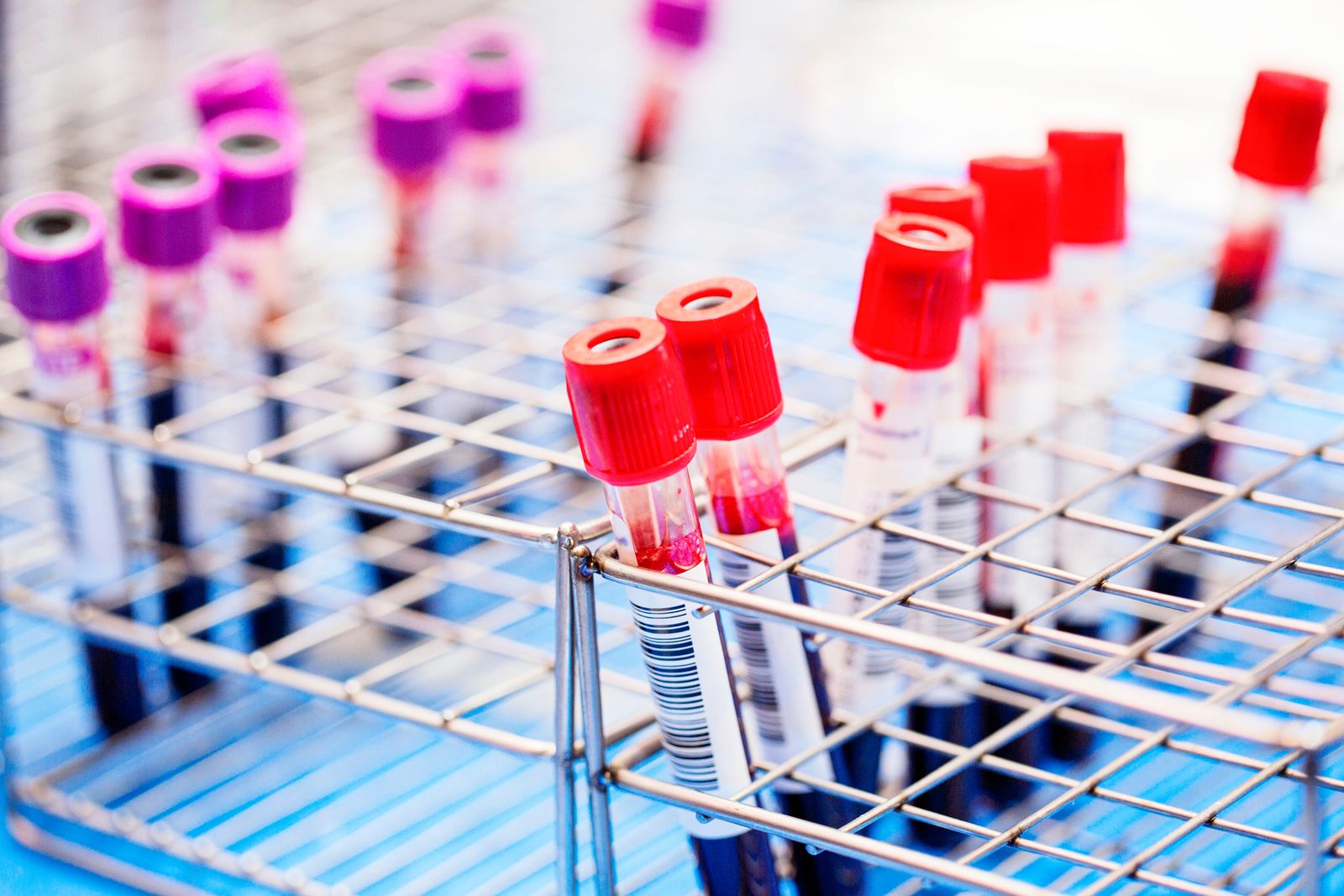 Анализ крови на болезнь Альцгеймера превосходит стандартную диагностику в новом исследовании