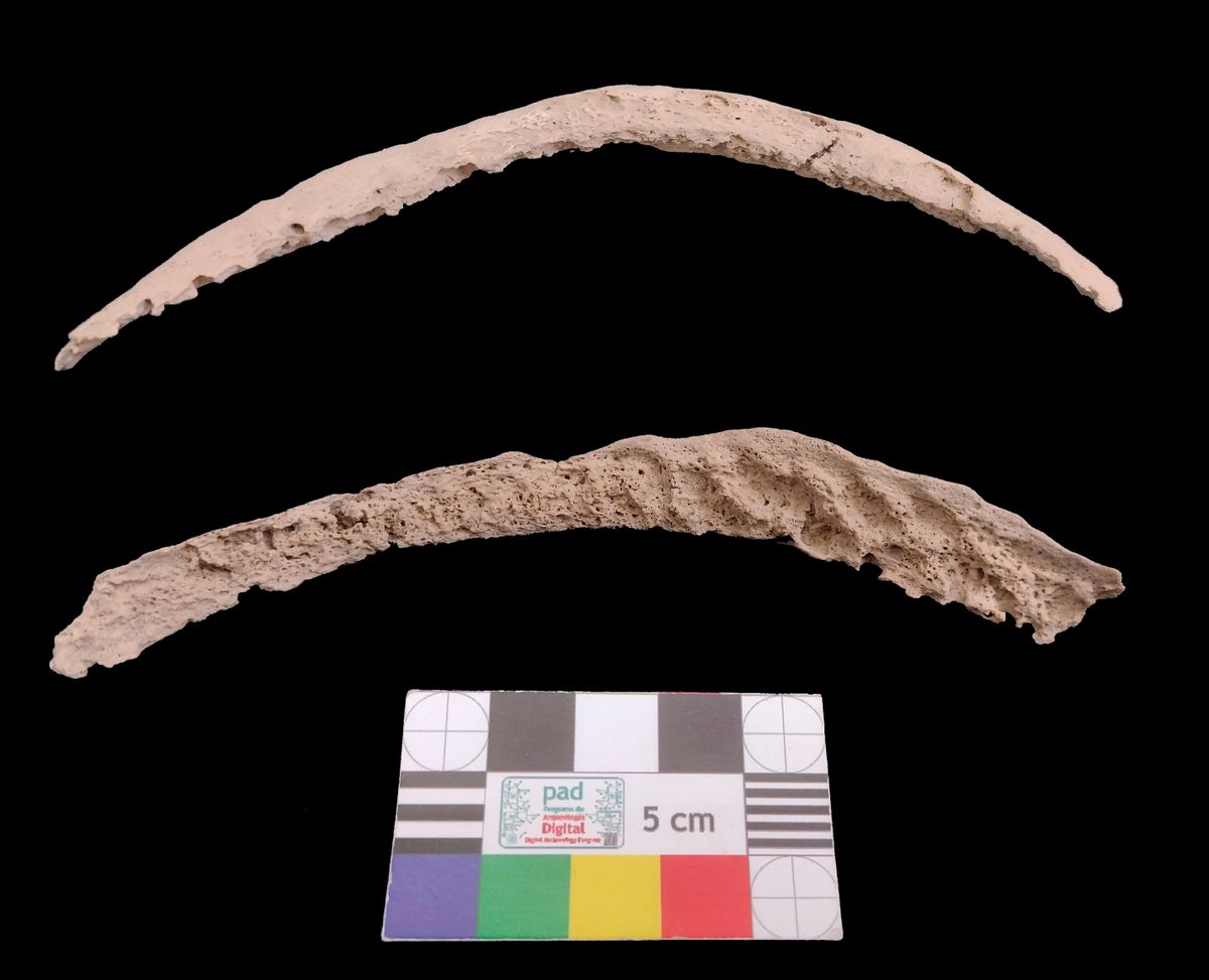 Древняя ДНК дает важные подсказки о происхождении сифилиса, загадки длиной в десятилетия, которая разделила ученых