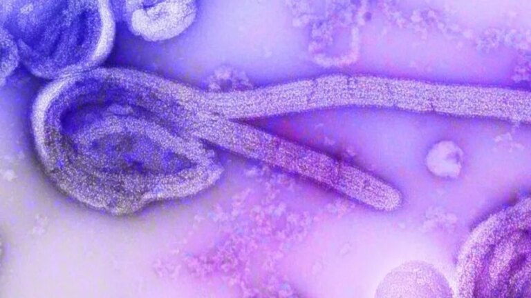 ebola