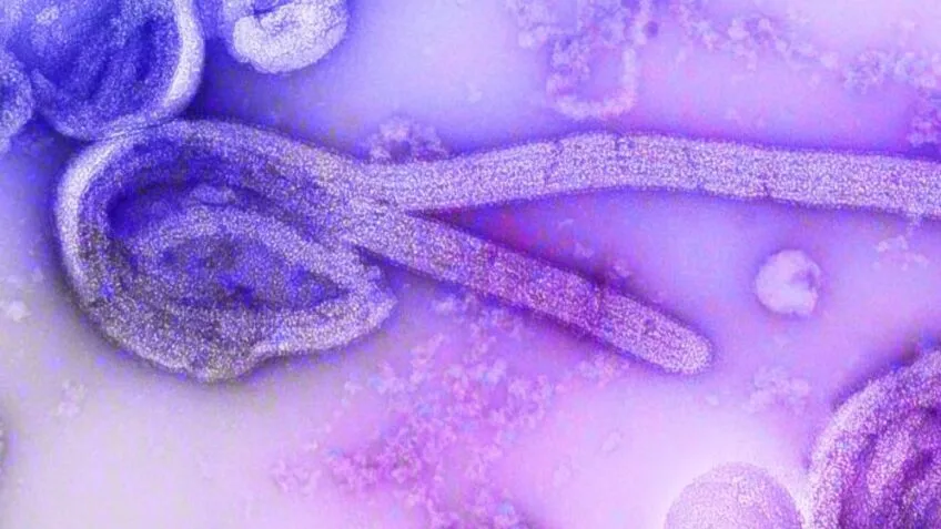 ebola